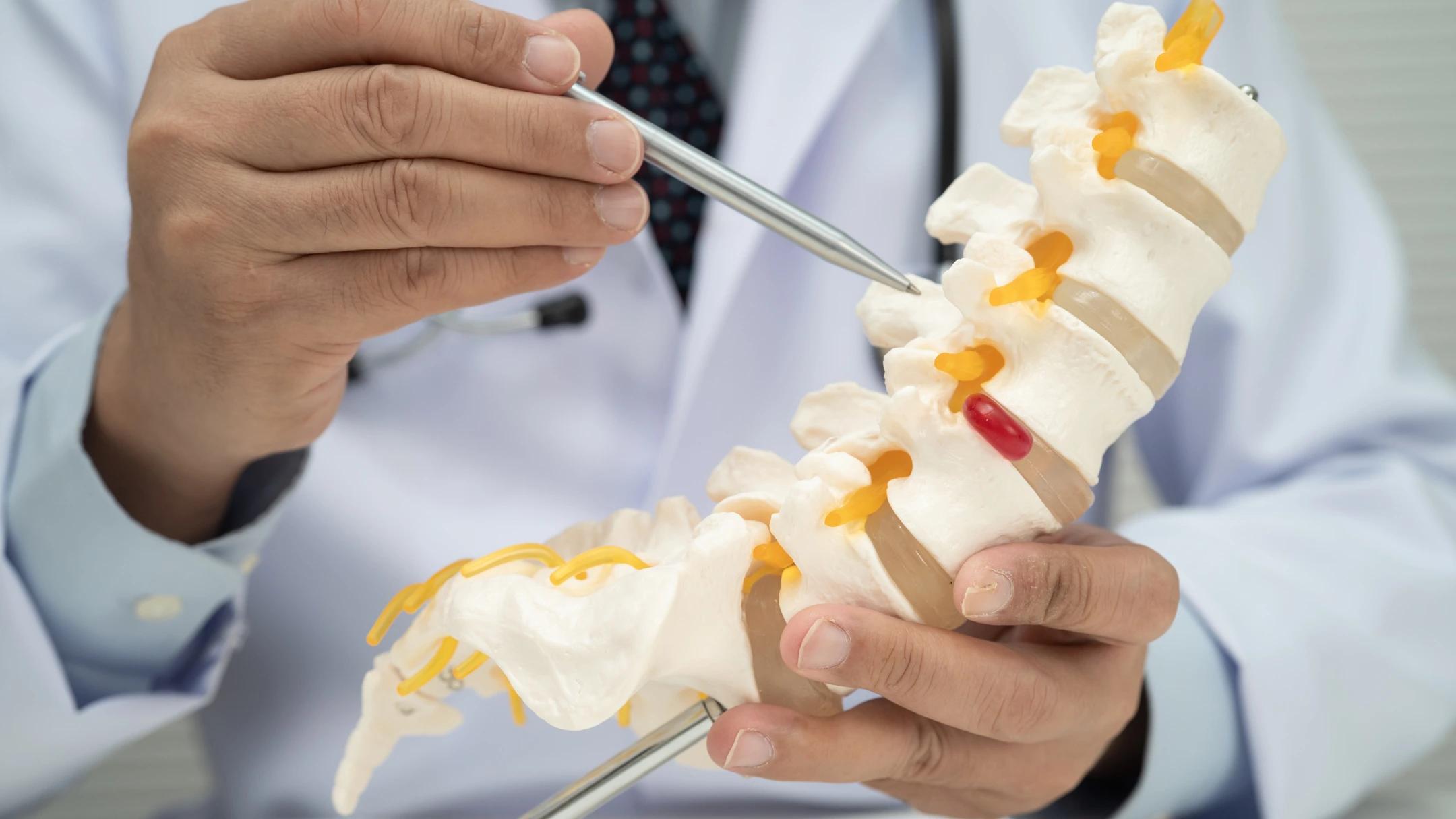 The Truth About Inflammation & Lower Back Pain: Should You Really Be Reducing It?