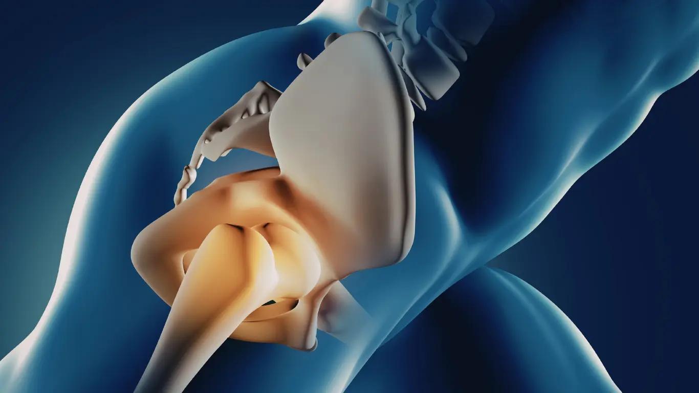 Back of Hip Pain: Causes, Evidence‑Based Treatments and the Path to Relief