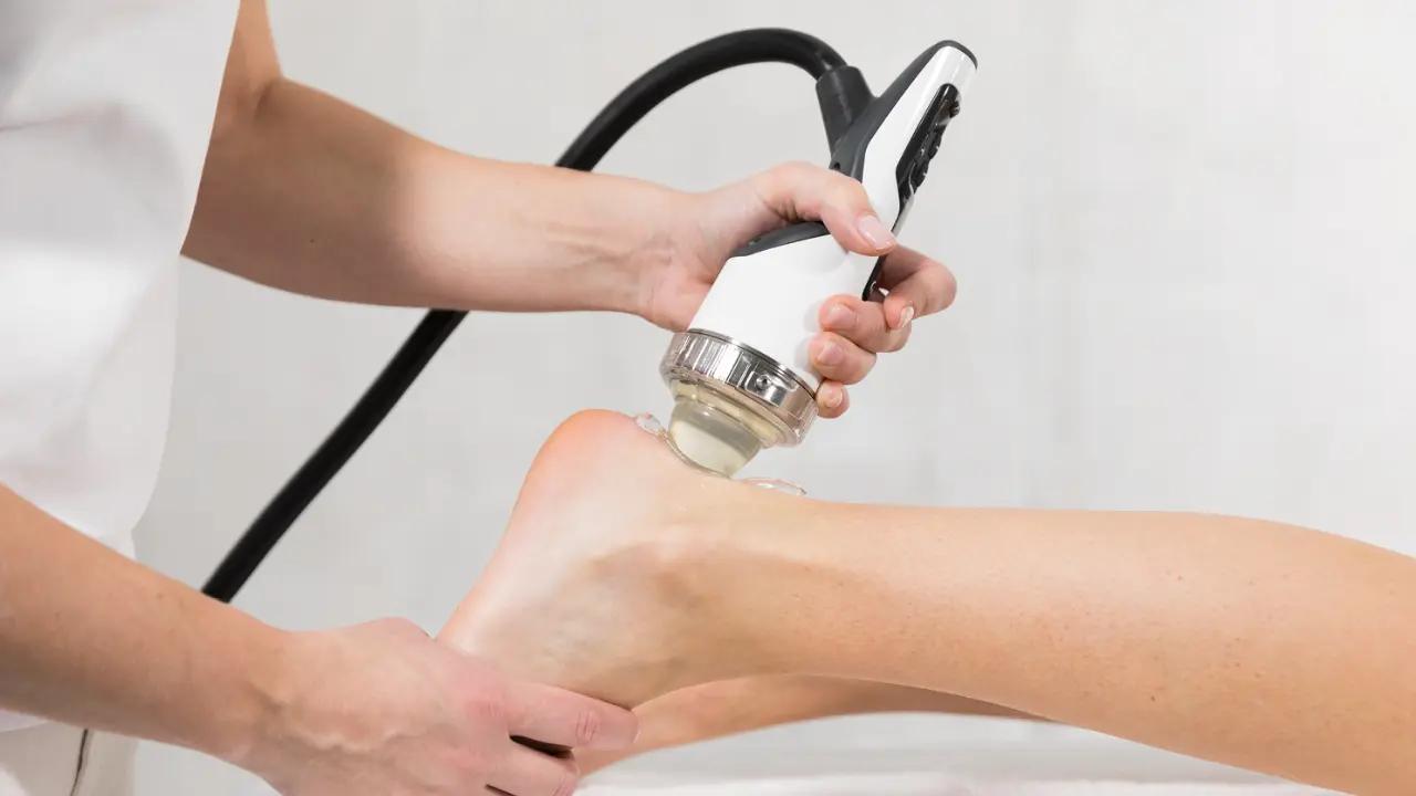 Shockwave Therapy for Achilles Tendinopathy: A Non-Surgical Solution for Chronic Heel Pain