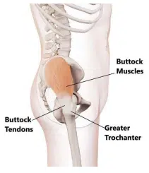 Location of greater trochanter